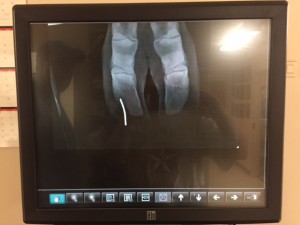 x ray of cow hoof with nail inside